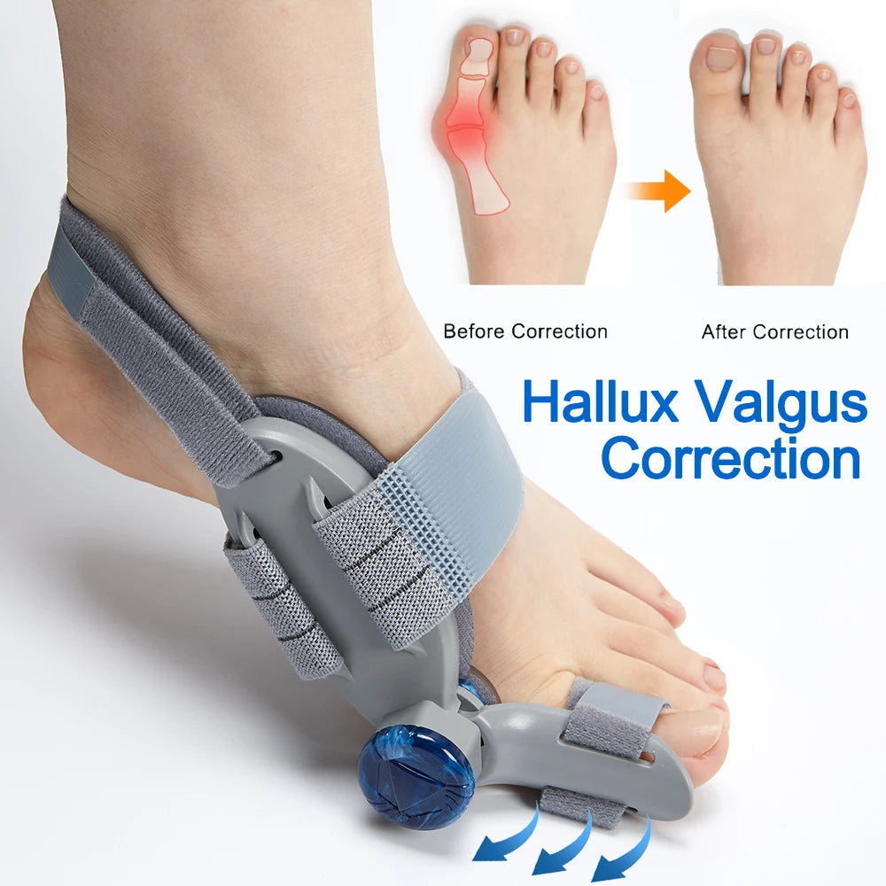 Bunion corrector