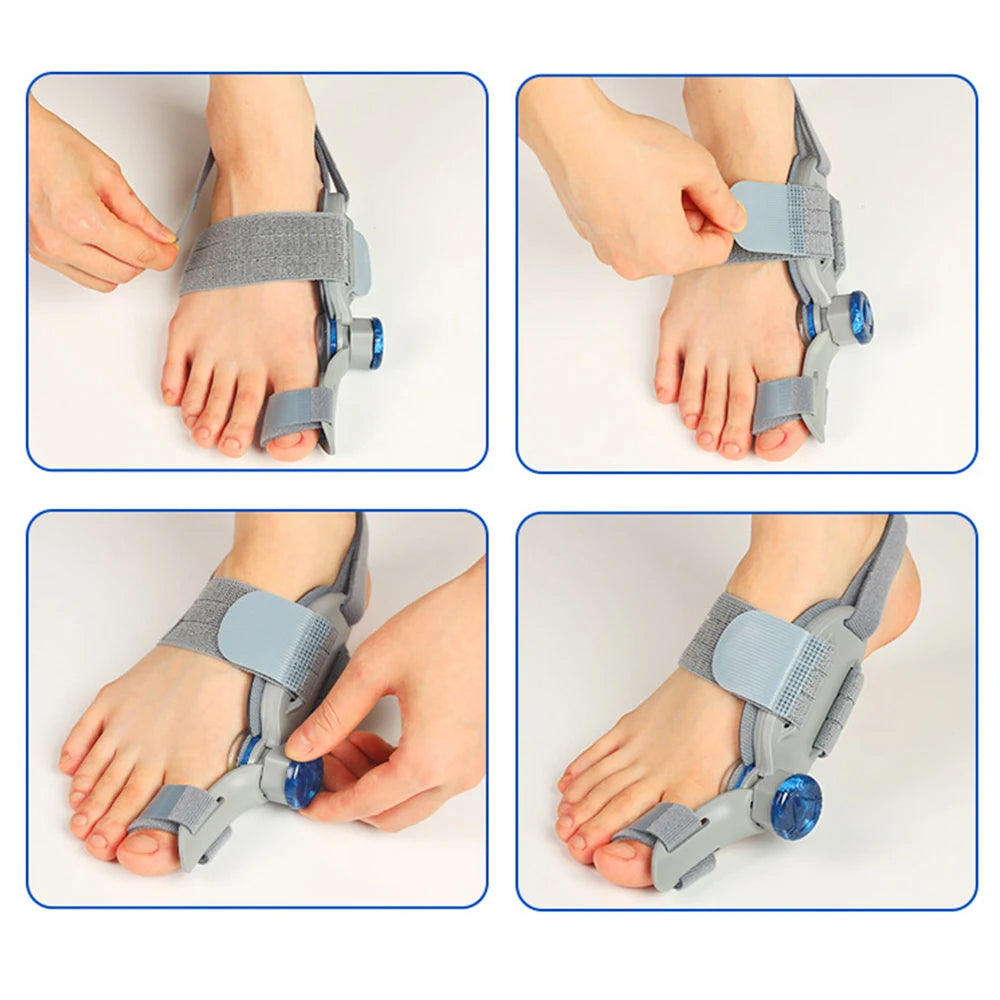 Bunion corrector