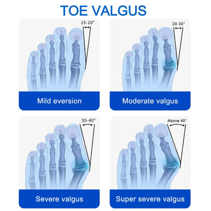 Bunion corrector